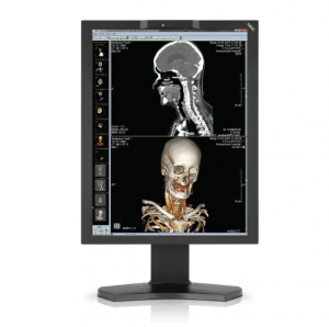 NEC MD 211C2 - 2MP Color